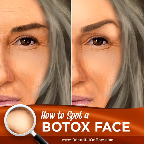 botox signs brows face consequences overarching raw